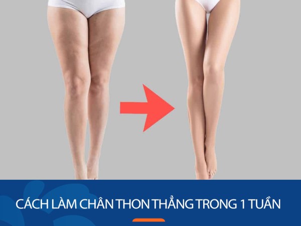 Cách làm chân thon và thẳng trong 1 tuần bài tập cấp tốc Cách làm chân thon và thẳng trong 1 tuần bài tập cấp tốc